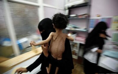 How U.S.-British policy helps starve Yemenis