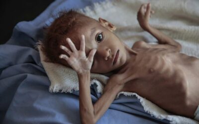 Negotiators hunt band-aid for Yemen’s agony