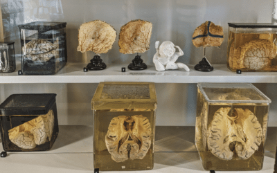 An exhibit of brains in jars at the Rīga Stradiņš University Anatomy Museum, Riga, Latvia.