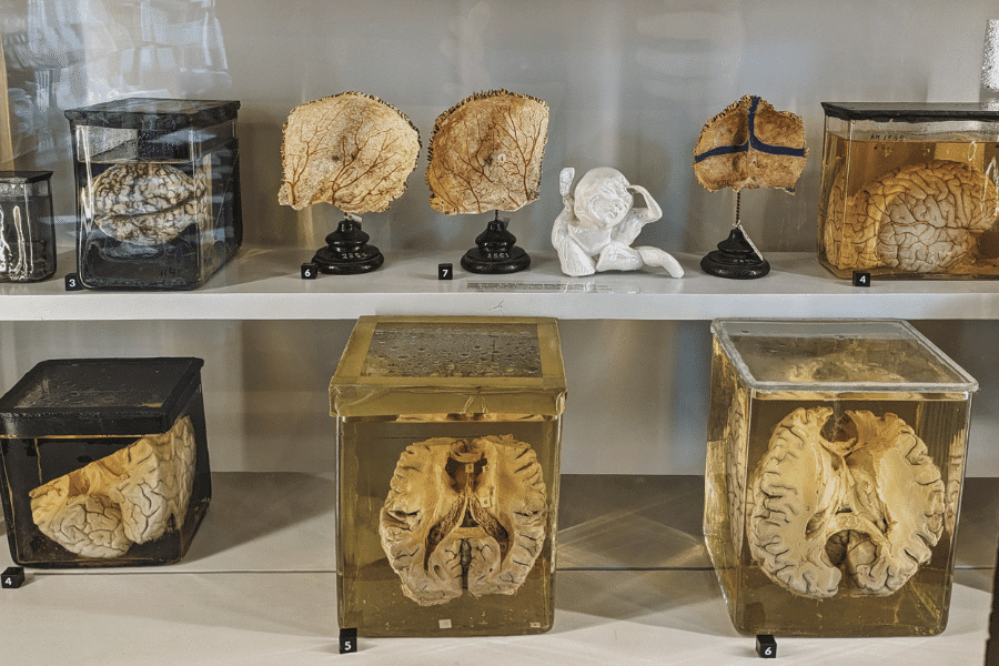 Miles of mosaics and brains in jars